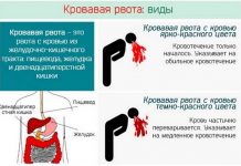 Размножение цветов черенками в домашних условиях 175